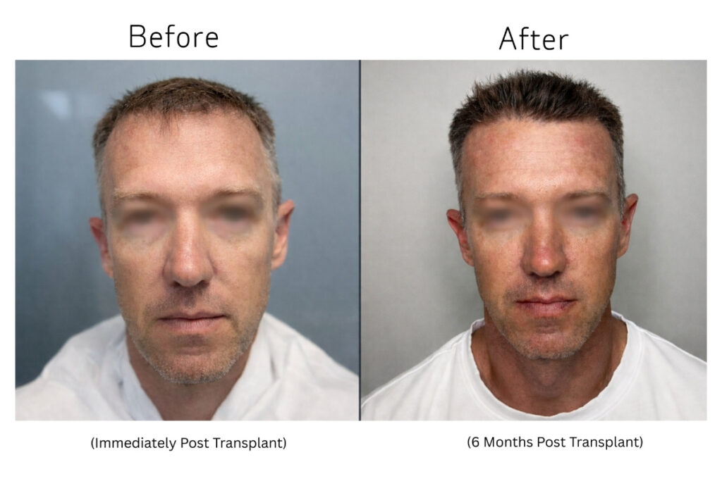 Horizontal Images